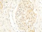 Phospho-Histone H3 (Ser11) Antibody in Immunohistochemistry (Paraffin) (IHC (P))