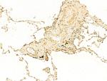 Phospho-Histone H3 (Ser11) Antibody in Immunohistochemistry (Paraffin) (IHC (P))