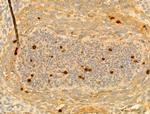 Phospho-Histone H3 (Ser11) Antibody in Immunohistochemistry (Paraffin) (IHC (P))