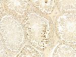 Phospho-Histone H3 (Ser11) Antibody in Immunohistochemistry (Paraffin) (IHC (P))