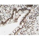 Phospho-Histone H3 (Ser11) Antibody in Immunohistochemistry (Paraffin) (IHC (P))