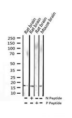 Phospho-Histone H3 (Ser11) Antibody in Western Blot (WB)