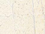 Phospho-Smad3 (Ser425) Antibody in Immunohistochemistry (Paraffin) (IHC (P))