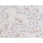 Phospho-FOXO4 (Thr451) Antibody in Immunohistochemistry (Paraffin) (IHC (P))