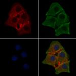 Phospho-CDK5 (Tyr15) Polyclonal Antibody