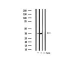 Phospho-CDK5 (Tyr15) Antibody in Western Blot (WB)