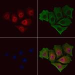 Phospho-NFkB p52/p100 (Ser870) Polyclonal Antibody