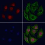 Phospho-NFkB p100 (Ser872) Polyclonal Antibody