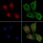 Phospho-E2F1 (Thr433) Polyclonal Antibody