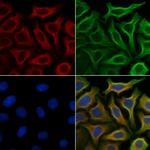 Phospho-MEK1 (Thr292) Antibody in Immunocytochemistry (ICC/IF)