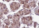 Phospho-MAP2K1/MAP2K2 (Ser218) Polyclonal Antibody