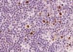 Phospho-NFkB p65 (Ser311) Antibody in Immunohistochemistry (Paraffin) (IHC (P))