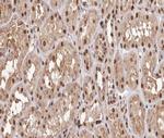 Phospho-NFkB p65 (Thr254) Polyclonal Antibody