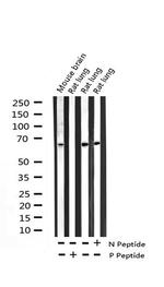 Phospho-NFkB p65 (Thr254) Antibody in Western Blot (WB)