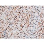 Phospho-NFkB p65 (Thr435) Polyclonal Antibody