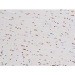 Phospho-NFkB p65 (Thr435) Antibody in Immunohistochemistry (Paraffin) (IHC (P))