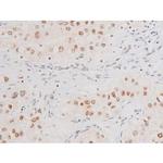 Phospho-NFkB p65 (Ser281) Antibody in Immunohistochemistry (Paraffin) (IHC (P))