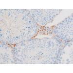 Phospho-Dynamin 1 (Ser774) Polyclonal Antibody