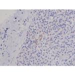 Phospho-FAK (Tyr576) Antibody in Immunohistochemistry (Paraffin) (IHC (P))