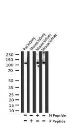Phospho-FAK (Tyr925) Antibody in Western Blot (WB)