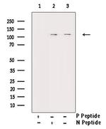 Phospho-FAK (Ser843) Antibody in Western Blot (WB)