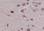 Phospho-PKC zeta (Thr410) Antibody in Immunohistochemistry (Paraffin) (IHC (P))