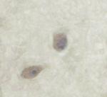 Phospho-PKC zeta (Thr560) Polyclonal Antibody