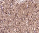 Phospho-NMDAR1 (Ser897) Polyclonal Antibody