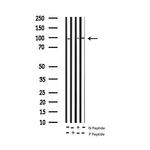 Phospho-PKC delta (Tyr64) Polyclonal Antibody