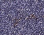 Phospho-Caldesmon (Ser789) Antibody in Immunohistochemistry (Paraffin) (IHC (P))