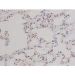 Phospho-Bcl-xL (Thr47) Antibody in Immunohistochemistry (Paraffin) (IHC (P))