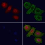 Phospho-FOXO1 (Ser319) Polyclonal Antibody