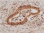 Phospho-FOXO1 (Ser319) Antibody in Immunohistochemistry (Paraffin) (IHC (P))