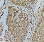 Phospho-FOXO1 (Ser319) Antibody in Immunohistochemistry (Paraffin) (IHC (P))