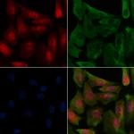 Phospho-FOXO1/FOXO3/FOXO4 (Thr24, Thr32) Antibody in Immunocytochemistry (ICC/IF)