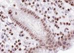 Phospho-FOXO1/FOXO3/FOXO4 (Thr24, Thr32) Antibody in Immunohistochemistry (Paraffin) (IHC (P))