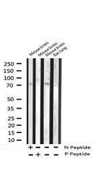 Phospho-FOXO1/FOXO3/FOXO4 (Thr24, Thr32) Antibody in Western Blot (WB)