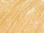 Phospho-Acetyl-CoA Carboxylase (Ser80) Antibody in Immunohistochemistry (Paraffin) (IHC (P))