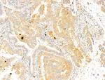 Phospho-Acetyl-CoA Carboxylase (Ser80) Antibody in Immunohistochemistry (Paraffin) (IHC (P))