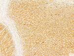 Phospho-Acetyl-CoA Carboxylase (Ser80) Antibody in Immunohistochemistry (Paraffin) (IHC (P))