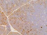 Phospho-Acetyl-CoA Carboxylase (Ser80) Antibody in Immunohistochemistry (Paraffin) (IHC (P))
