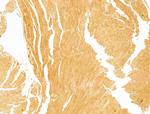 Phospho-Acetyl-CoA Carboxylase (Ser80) Antibody in Immunohistochemistry (Paraffin) (IHC (P))