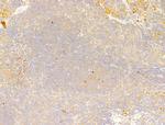Phospho-Acetyl-CoA Carboxylase (Ser80) Antibody in Immunohistochemistry (Paraffin) (IHC (P))