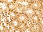 Phospho-Acetyl-CoA Carboxylase (Ser80) Antibody in Immunohistochemistry (Paraffin) (IHC (P))