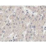 Phospho-Acetyl-CoA Carboxylase (Ser80) Antibody in Immunohistochemistry (Paraffin) (IHC (P))