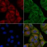 Phospho-PAK1 (Thr212) Polyclonal Antibody