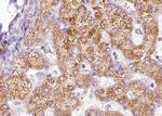 Phospho-PAK1 (Thr212) Antibody in Immunohistochemistry (Paraffin) (IHC (P))