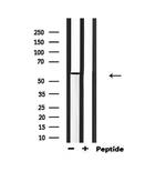 Phospho-PAK1 (Thr212) Antibody in Western Blot (WB)