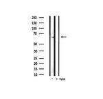 Phospho-PAK1 (Thr212) Antibody in Western Blot (WB)