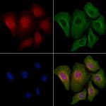 Phospho-4EBP1 (Thr36) Polyclonal Antibody